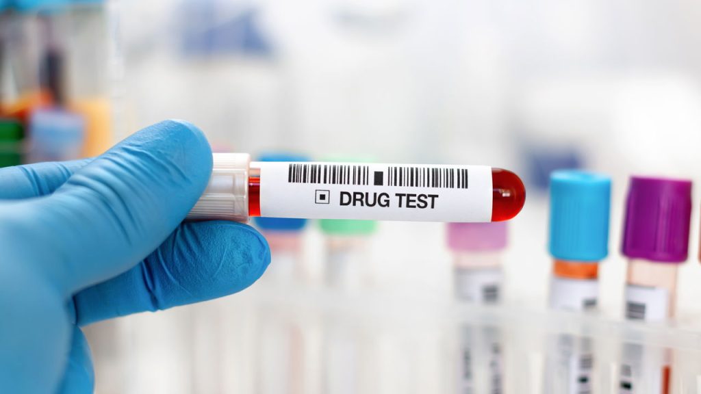 Nova lei quer exame toxicológico obrigatório para todos os motoristas!