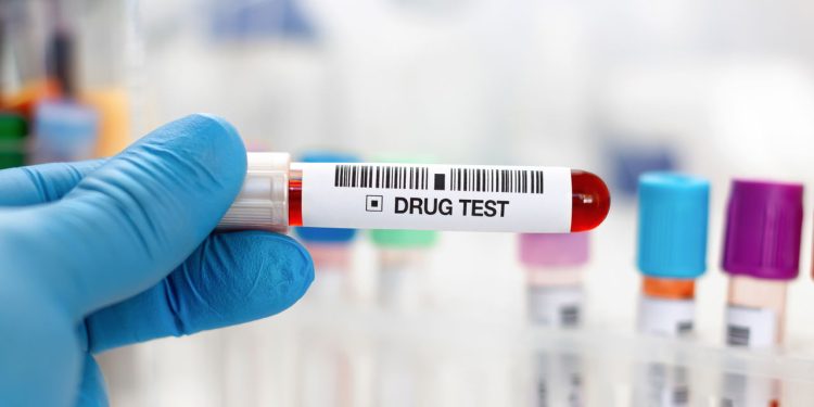 Exame toxicológico será obrigatório na 1ª habilitação em 2025