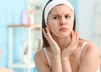 Adeus, acne! Faça você mesma essa máscara facial de até R$ 30