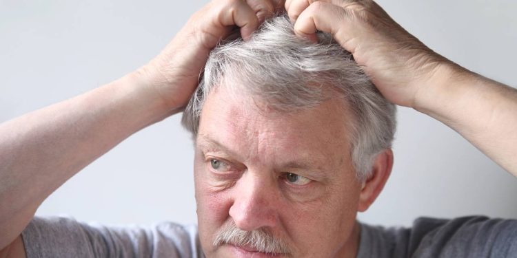 Compre seu shampoo para caspas por até R$ 40 e acabe com suas coceiras