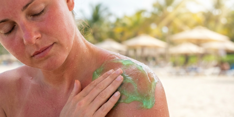 Pele ardendo depois da praia? 3 pós-sol baratos que reduzem a vermelhidão rápido e devolvem o conforto na mesma noite